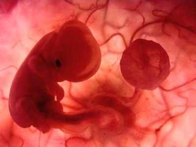 Các biện pháp chẩn đoán thai chậm phát triển trong tử cung