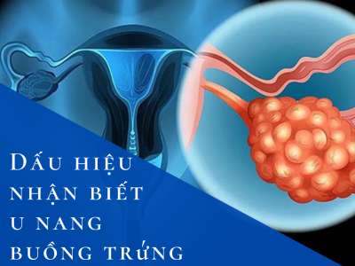 Dấu hiệu nhận biết u nang buồng trứng cần đi khám 