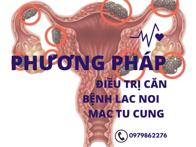 Phương pháp điều trị căn bệnh lac noi mac tu cung 