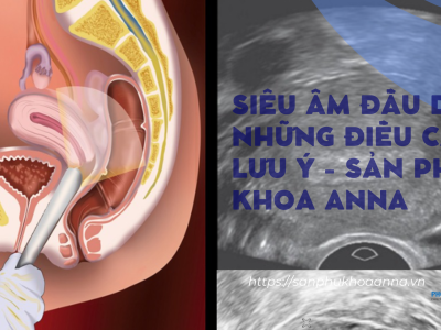 Siêu âm đầu dò - Những điều cần lưu ý - Sản phụ khoa Anna 