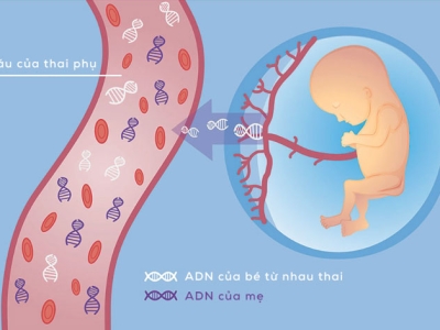 Tìm hiểu về Xét nghiệm NIPT sàng lọc dị tật trước sinh không xâm lấn