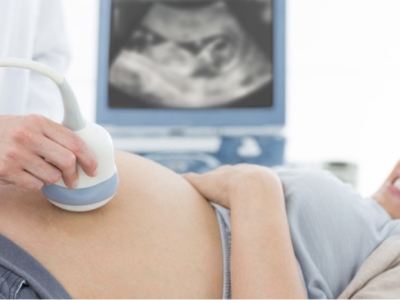 Siêu âm 4D trong thai kỳ: bạn nên lưu ý những gì?